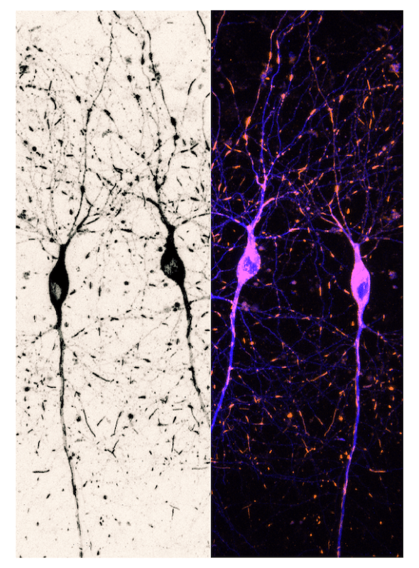 Evolution of Cajal’s drawings  © S. Rodriguez-Rozada, Center for Molecular Neurobiology Hamburg (DE)
